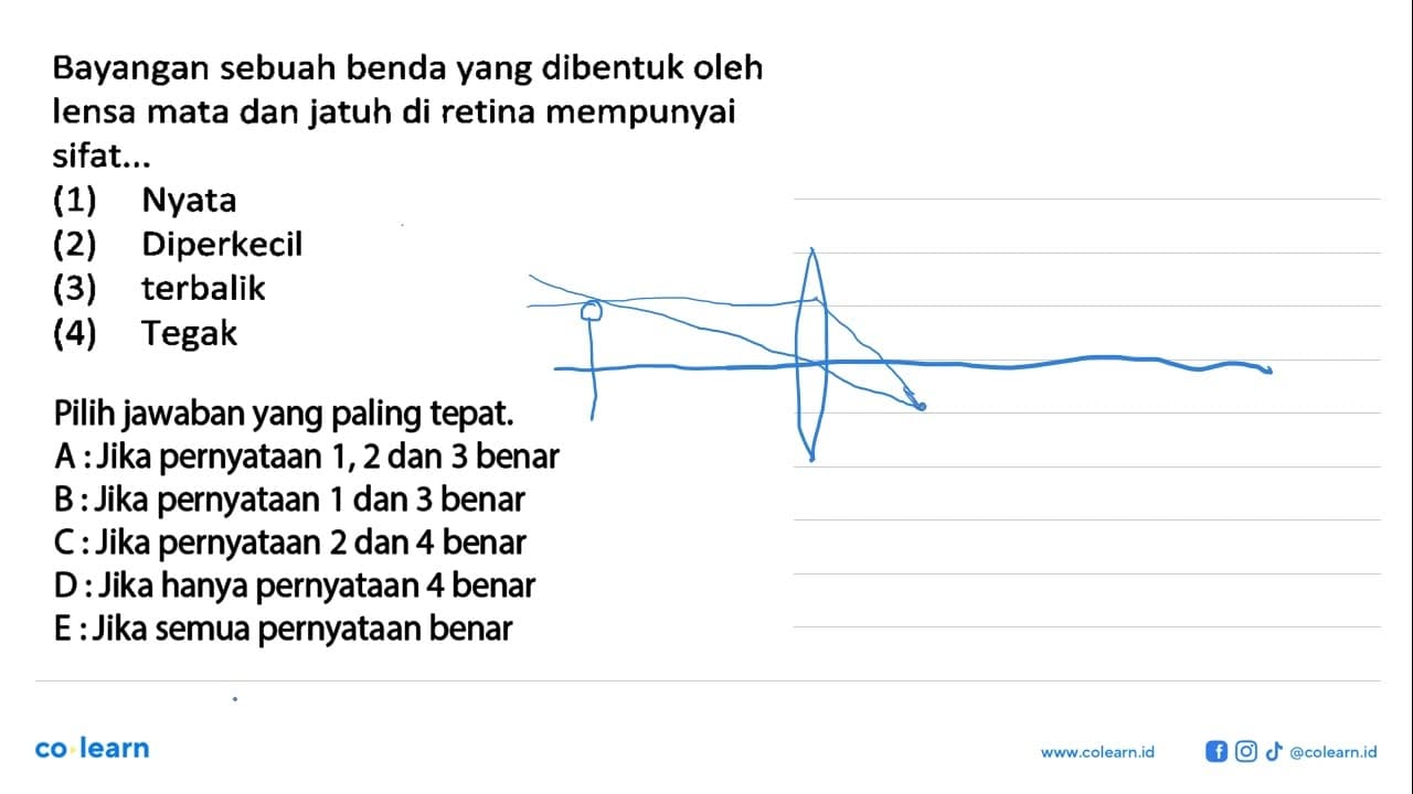 Bayangan sebuah benda yang dibentuk oleh lensa mata dan