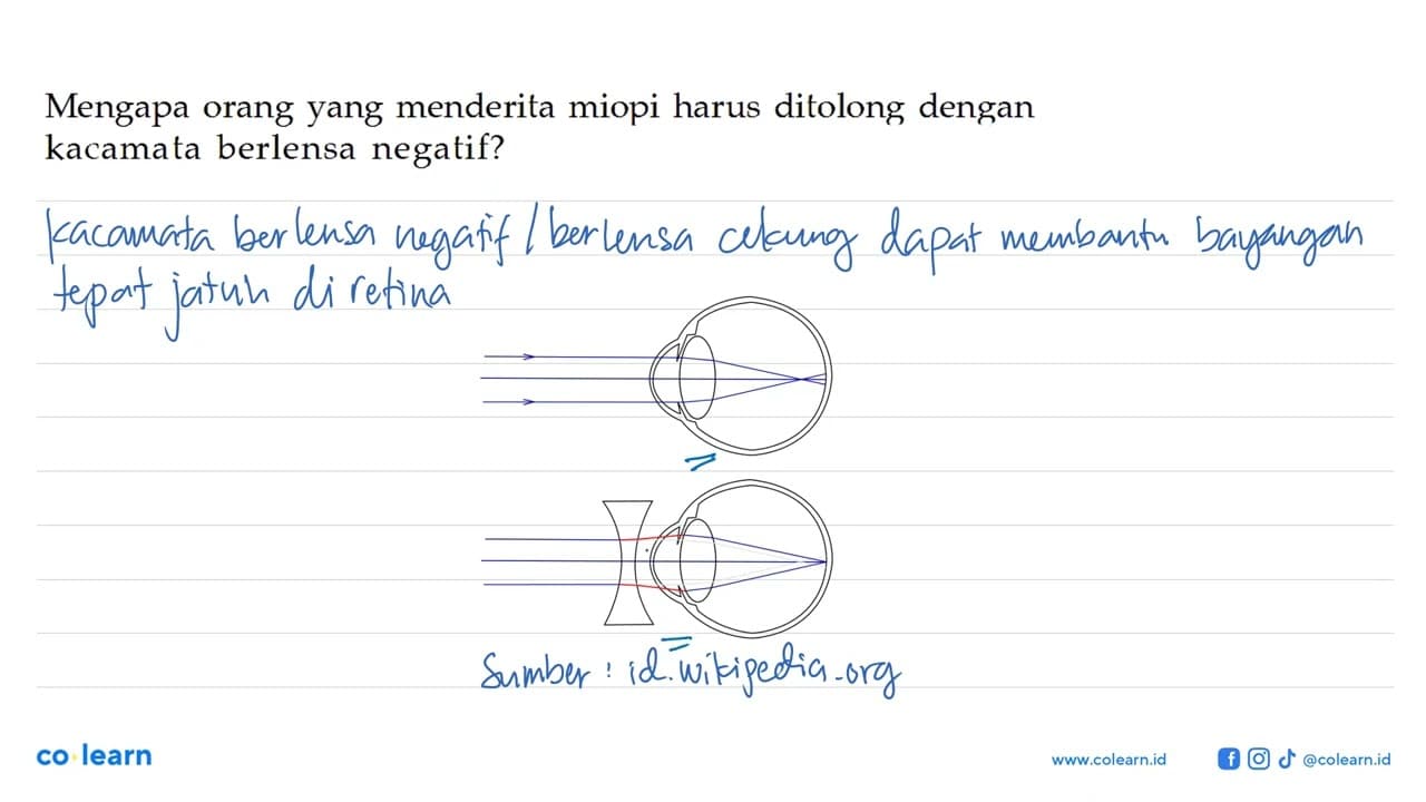 Mengapa orang yang menderita miopi harus ditolong dengan