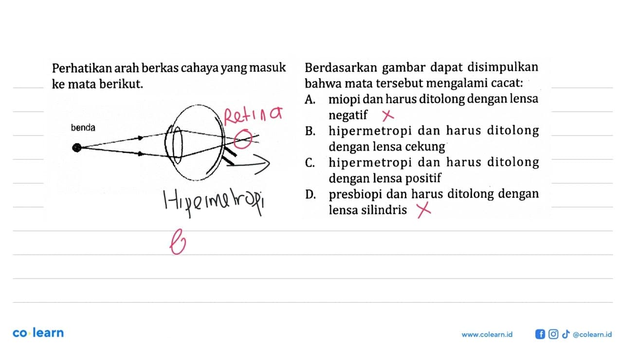 Perhatikan arah berkas cahaya yang masuk ke mata berikut.