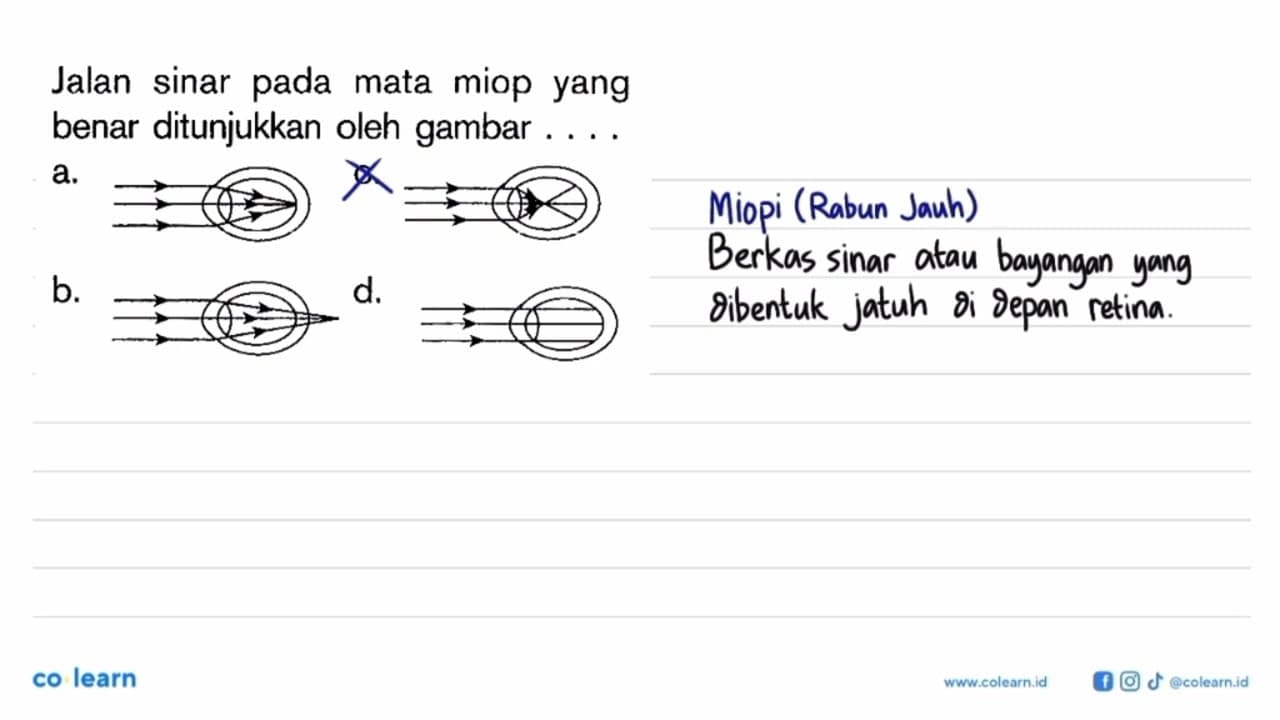 Jalan sinar pada mata miop yang benar ditunjukkan oleh