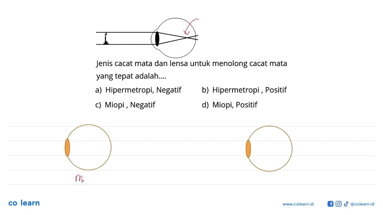 Jenis cacat mata dan lensa untuk menolong cacat mata yang