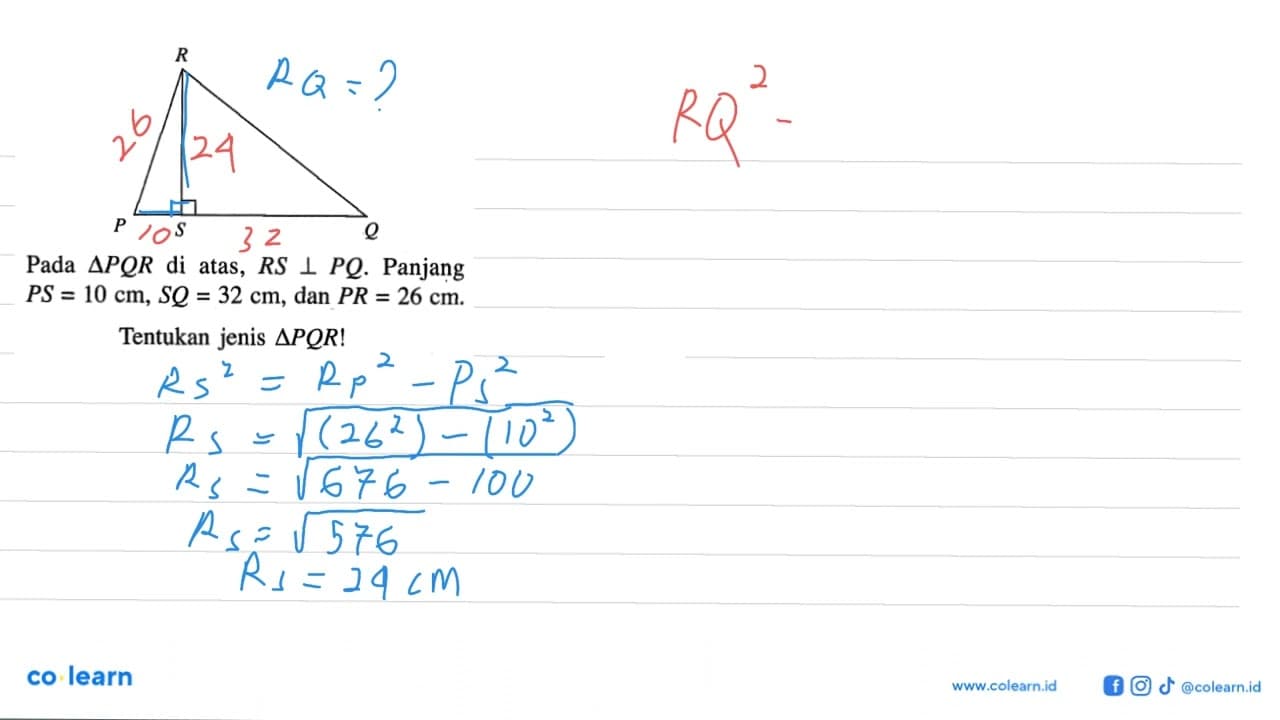 Pada segitiga PQR di atas, RS tegak lurus PQ. Panjang PS=10