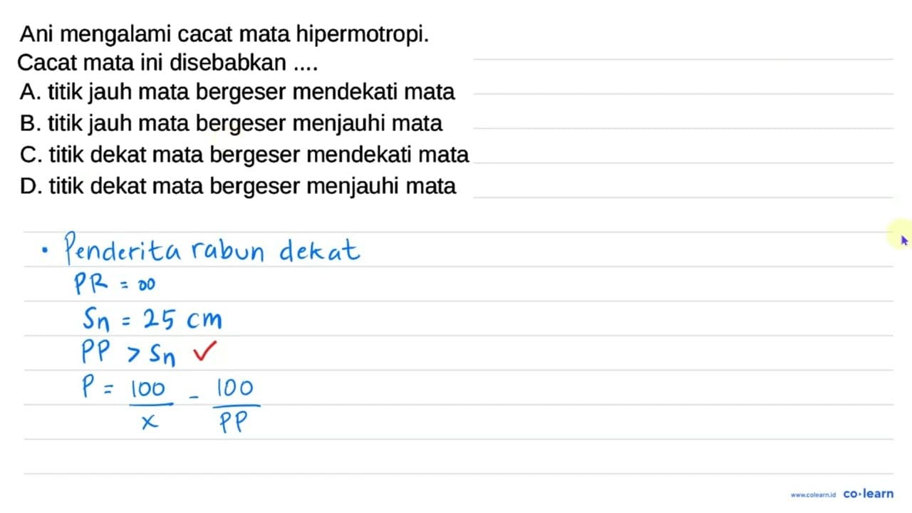 Ani mengalami cacat mata hipermotropi. Cacat mata ini