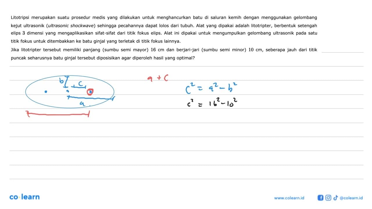 Litotripsi merupakan suatu prosedur medis yang dilakukan