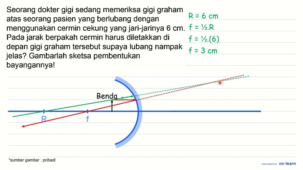 Seorang dokter gigi sedang memeriksa gigi graham atas