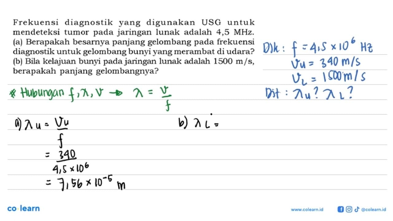 Frekuensi diagnostik yang digunakan USG untuk mendeteksi