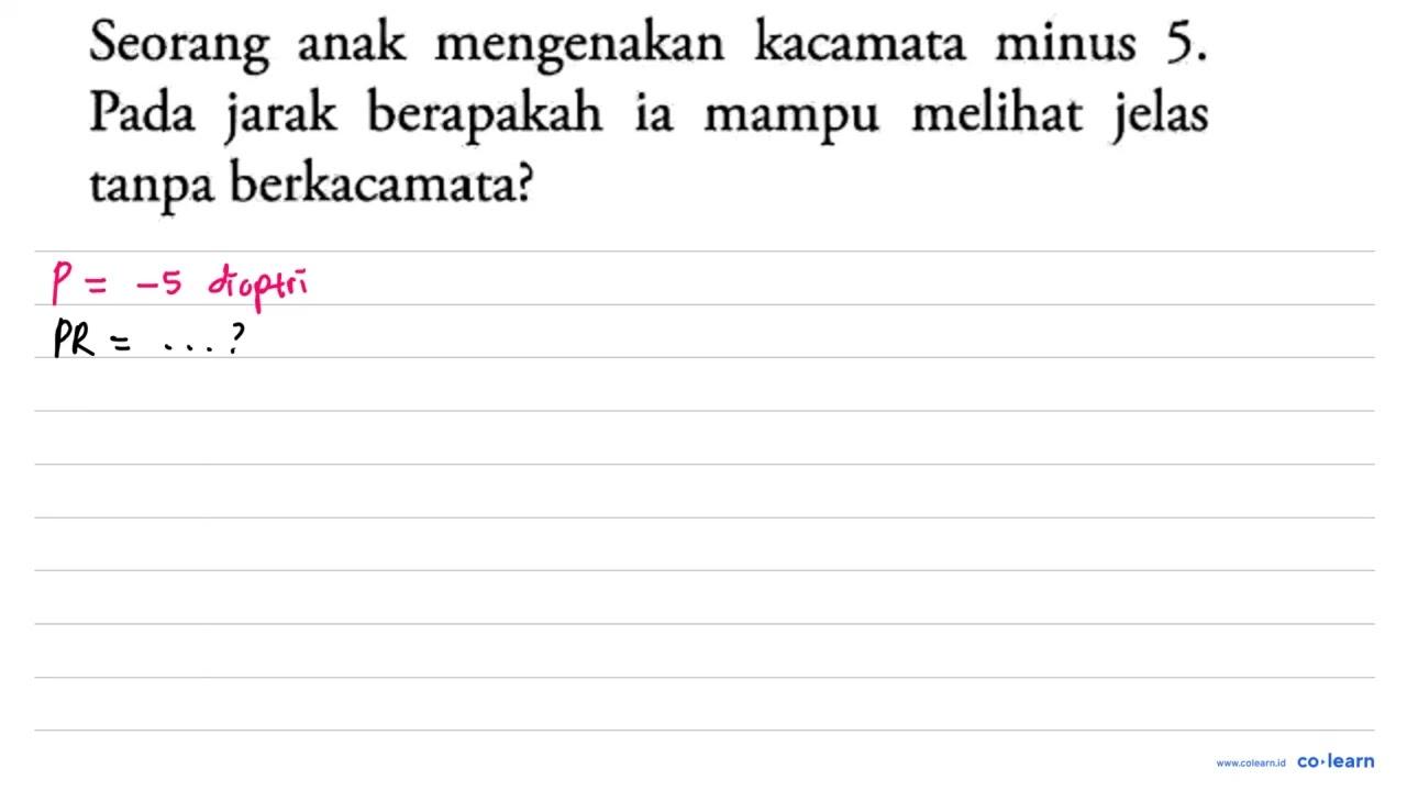 Seorang anak mengenakan kacamata minus 5. Pada jarak