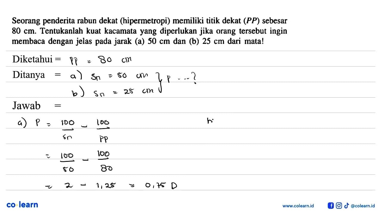 Seorang penderita rabun dekat (hipermetropi) memiliki titik