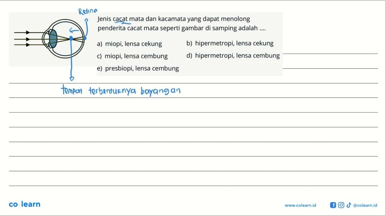 Jenis cacat mata dan kacamata yang dapat menolong penderita