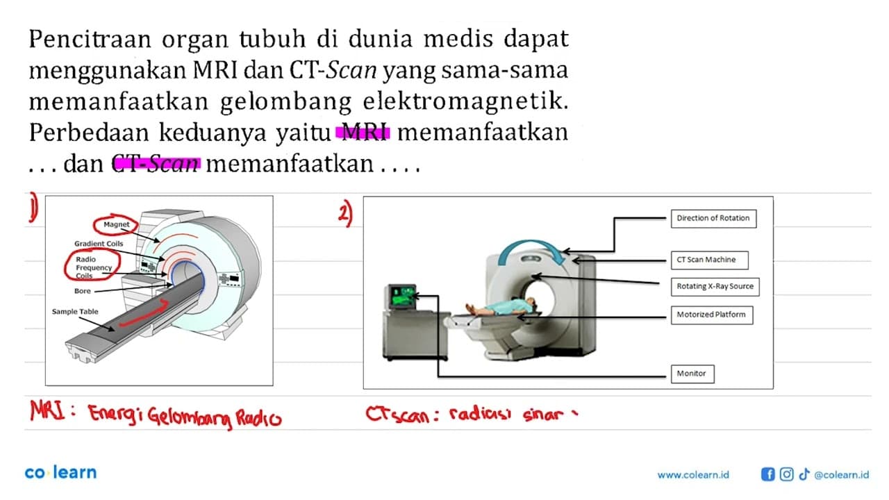 Pencitraan organ tubuh di dunia medis dapat menggunakan MRI