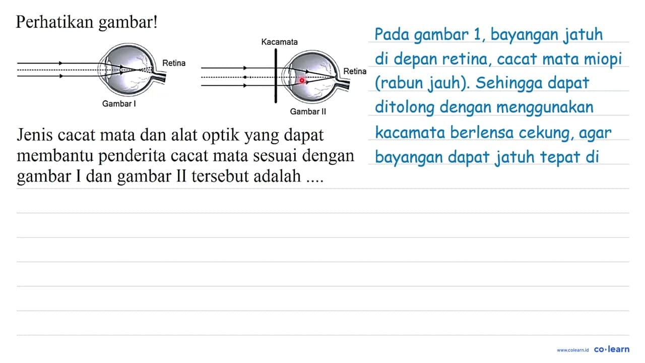 Perhatikan gambar! Jenis cacat mata dan alat optik yang