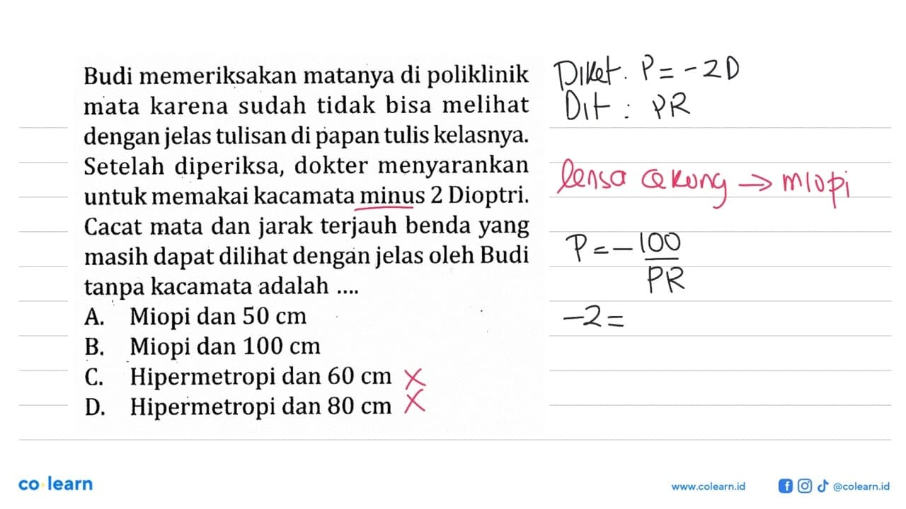 Budi memeriksakan matanya di poliklinik mata karena sudah