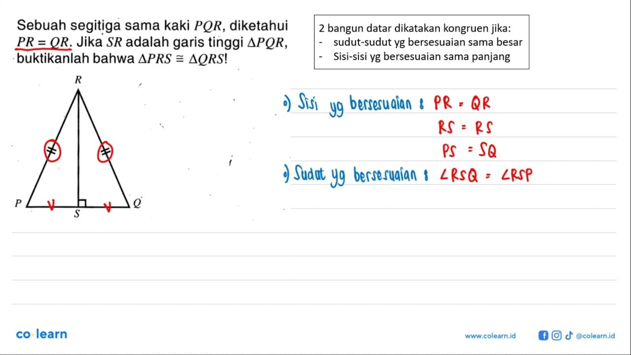Sebuah segitiga sama kaki PQR, diketahui PR=QR. Jika SR