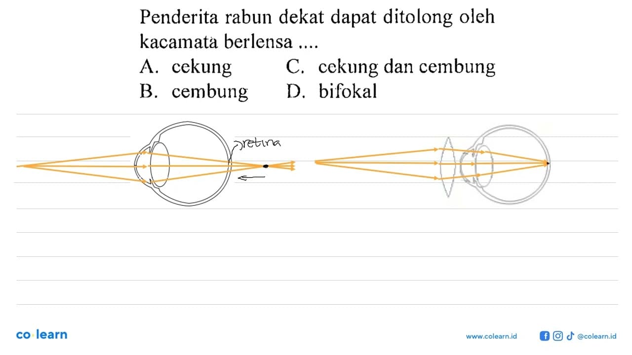 Penderita rabun dekat dapat ditolong oleh kacamata berlensa