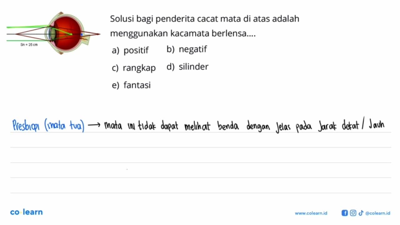 Sn = 25 cm Solusi bagi penderita cacat mata di atas adalah