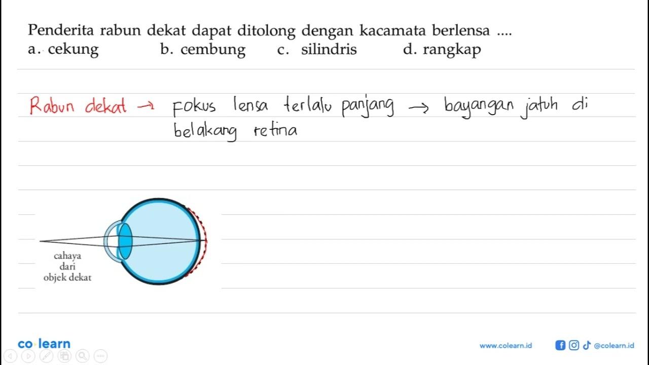 Penderita rabun dekat dapat ditolong dengan kacamata